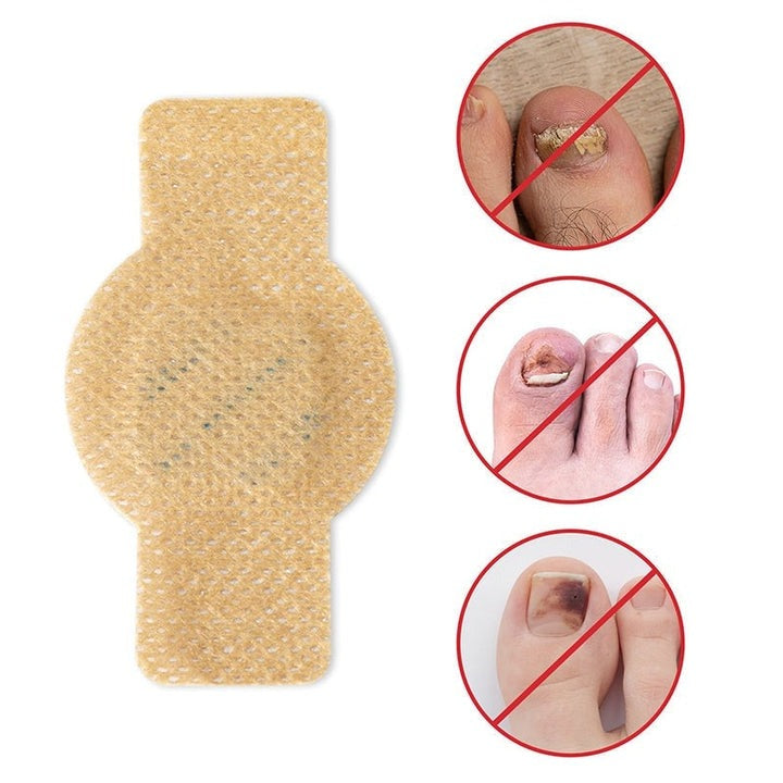 FungalPatch - Antibakterielles Antimykotisches Patch- und Nagelpflege-Set