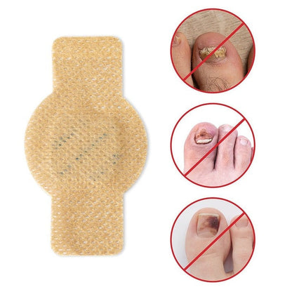 FungalPatch - Antibakterielles Antimykotisches Patch- und Nagelpflege-Set