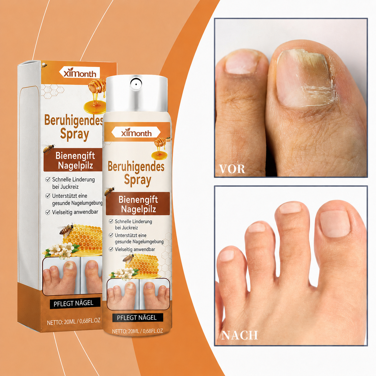 Bienengift-Spray gegen Nagelpilz