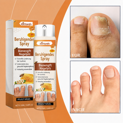 Bienengift-Spray gegen Nagelpilz