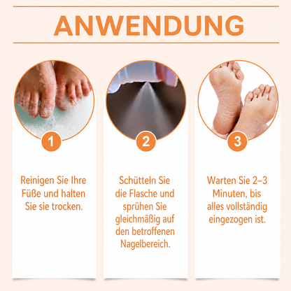 Bienengift-Spray gegen Nagelpilz